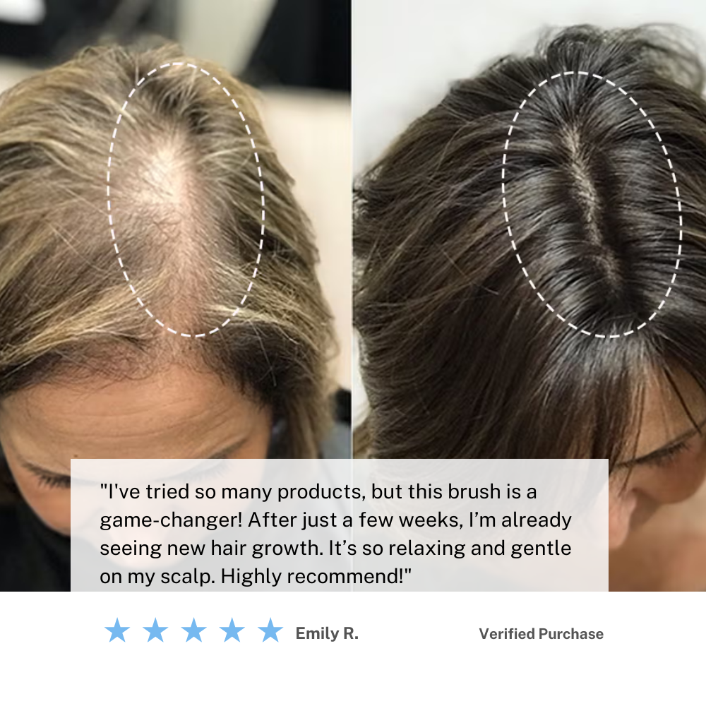 Kabellose Kopfhautmassagebürste – Fördern Sie das Haarwachstum & Entspannen Sie sich zu Hause