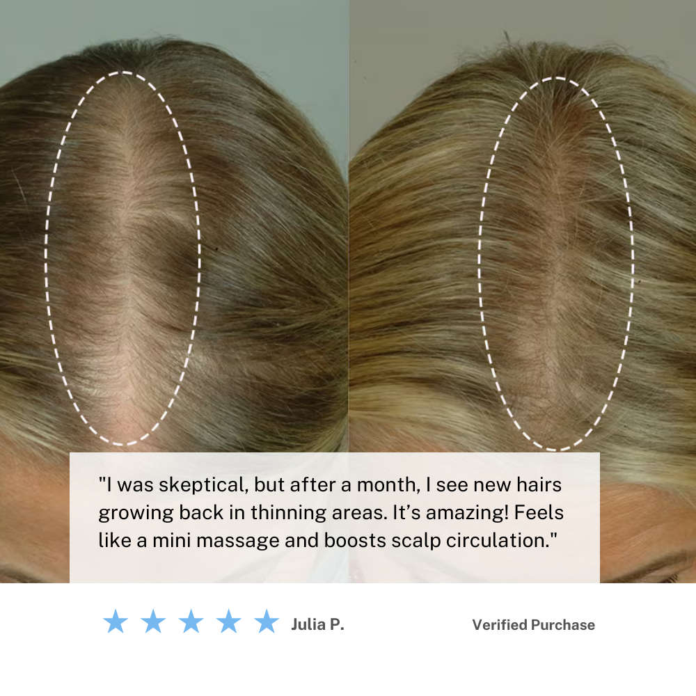 Kabellose Kopfhautmassagebürste – Fördern Sie das Haarwachstum & Entspannen Sie sich zu Hause