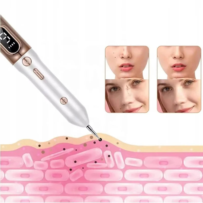 Plasma Pen zum Entfernen von Hautwarzen, Muttermalen und Warzen