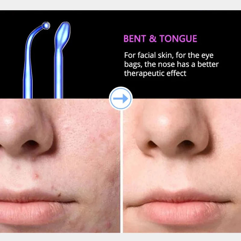 Professionelle Hochfrequenz Gesichts- & Haartherapie-Stab