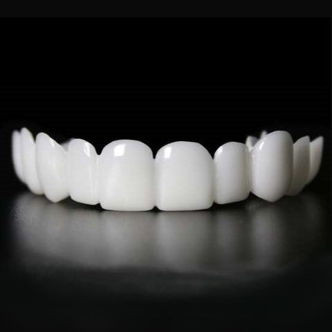 Sofortige Lächelverwandlung mit Snap on Smile Veneers