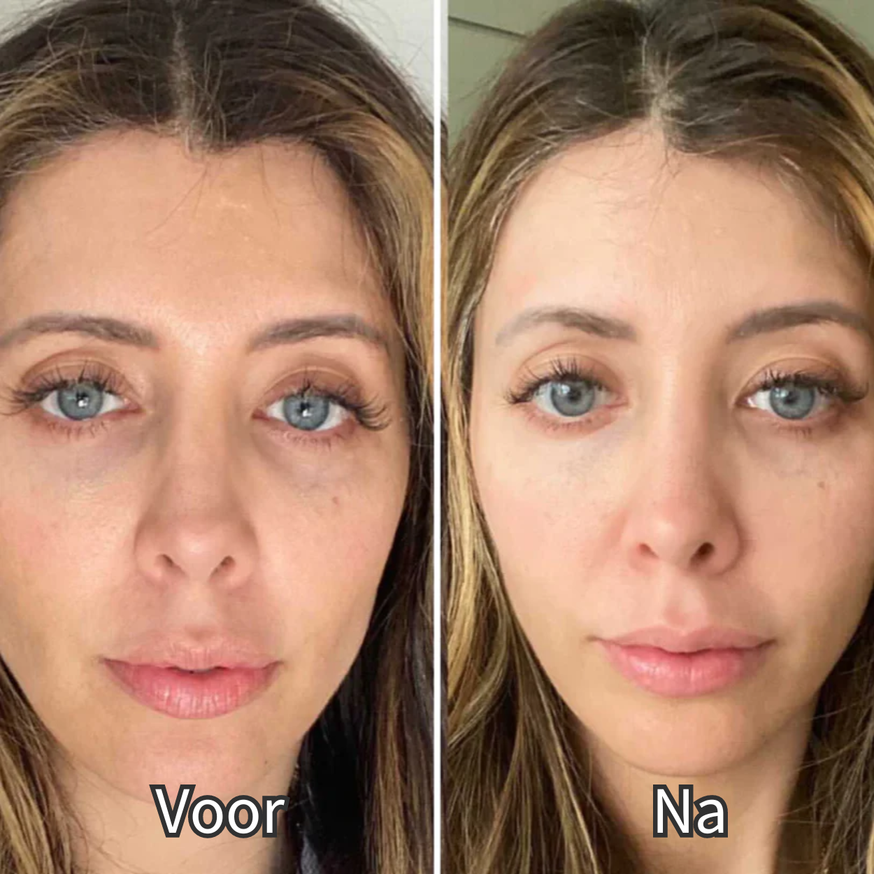 VitalGlow – Rotlichttherapie-Brille für Wohlbefinden und Erholung