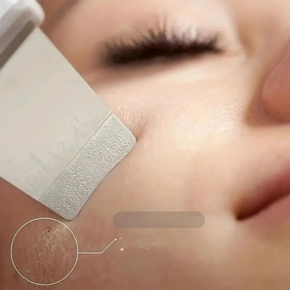 SkinSonic Ultrasonische Hautreiniger – Für Tiefenreinigung und Frische Poren