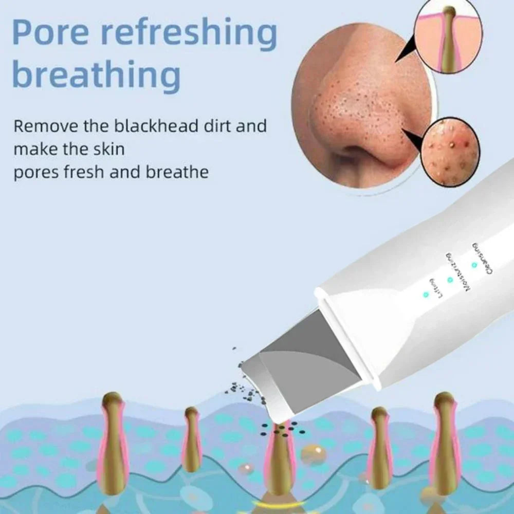 SkinSonic Ultrasonische Hautreiniger – Für Tiefenreinigung und Frische Poren