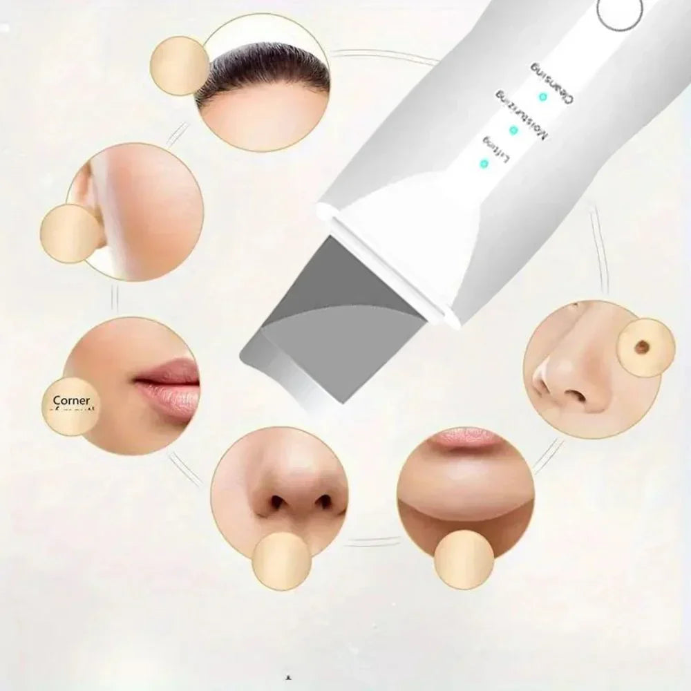 SkinSonic Ultrasonische Hautreiniger – Für Tiefenreinigung und Frische Poren