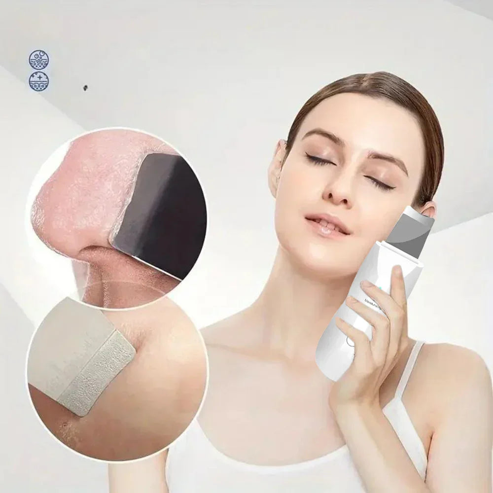 SkinSonic Ultrasonische Hautreiniger – Für Tiefenreinigung und Frische Poren