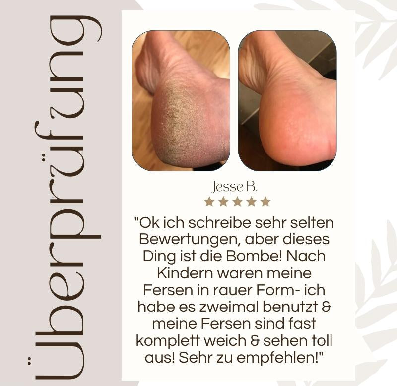 Elektrischer Hornhautentferner | LED-Licht | Wasserdicht