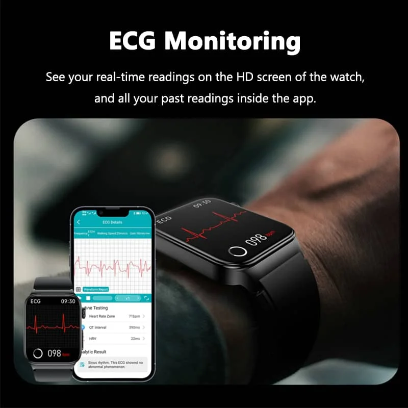 All-in-One Gesundheitsüberwachungs-Smartwatch mit ECG & Blutzuckermessgerät