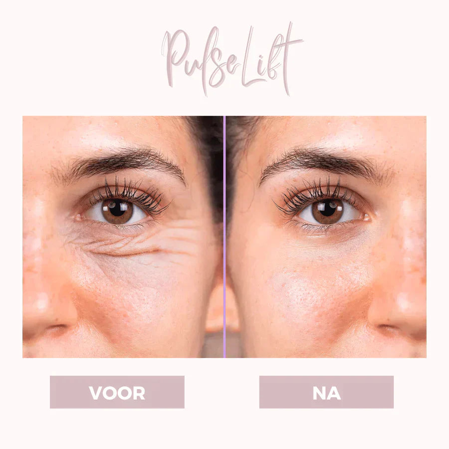 EyePat - Dermatologisches Augenlift-Gerät