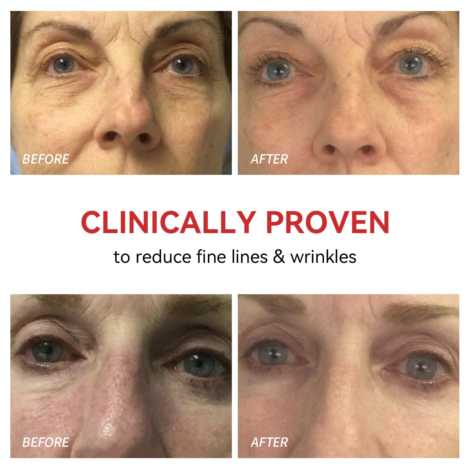 Rotlicht-Therapiegerät für Augen – Schmerzlinderung & Sehkraftverbesserung zu Hause