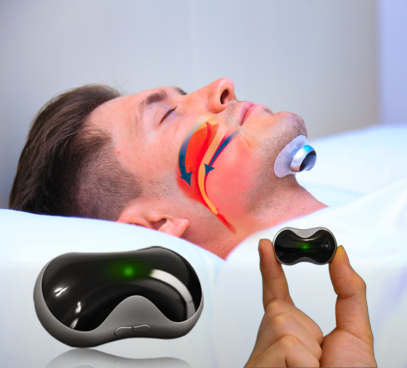 SnoozeFix Anti-Schnarch Gerät - Verbessere deinen Schlaf mit komfortabler Technologie