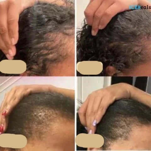 Natürliches Haarwuchsöl für kräftiges Haar