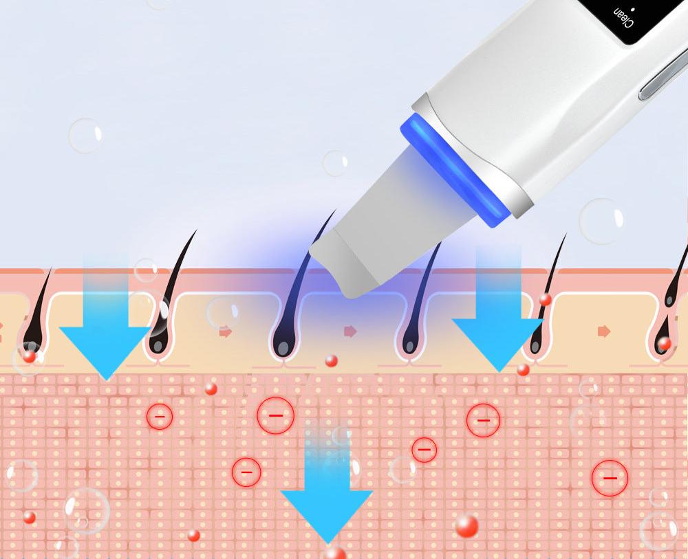 Zelara Ultrasonic Hautschaber