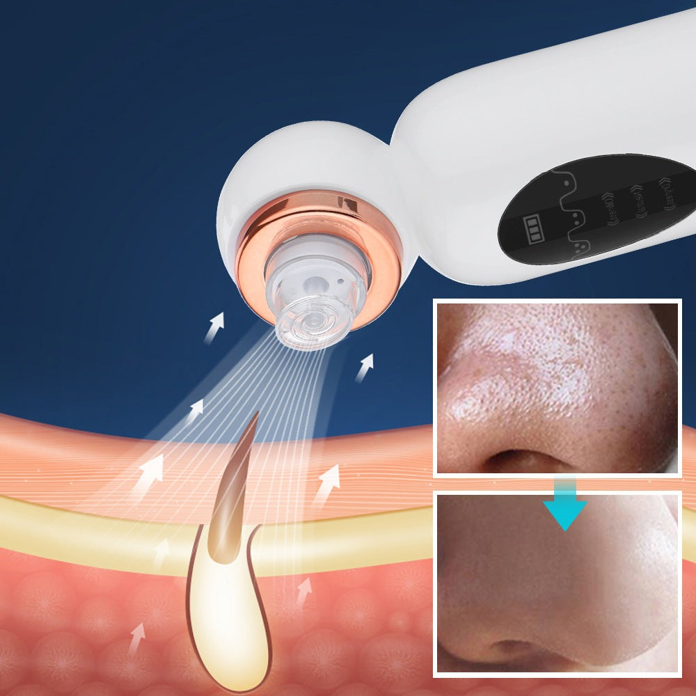 Zelara Hydrodermabrasion Mitesserentferner