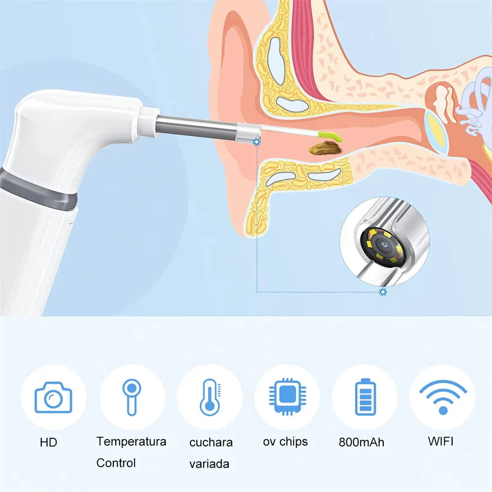 1080P HD Drahtlose Ohrkamera Otoskop mit 6 LED-Lichtern für Android- und iOS-Geräte