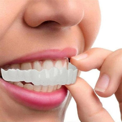 Smile Veneer (Oben &amp; Unten Inklusive)