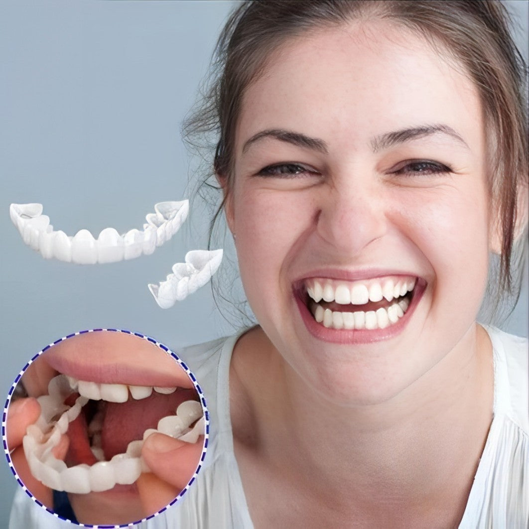 Smile Veneer (Oben &amp; Unten Inklusive)