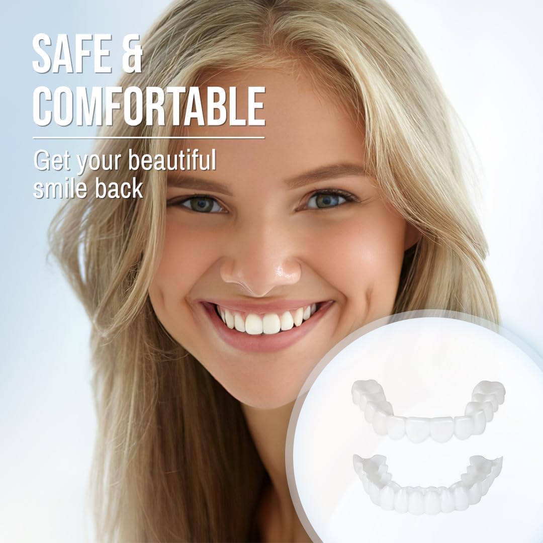 Smile Veneer (Oben &amp; Unten Inklusive)