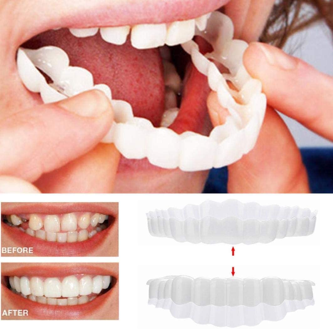Smile Veneer (Oben &amp; Unten Inklusive)