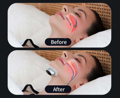 VernSleep Smart Schlafapnoe-Hilfe