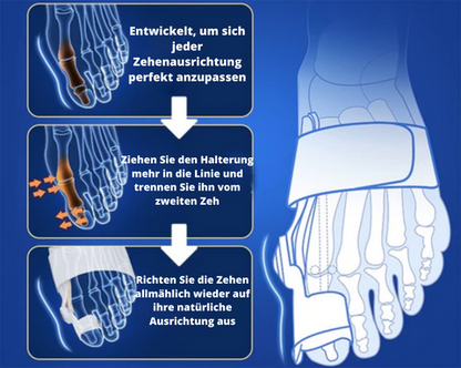 Zelara-Ballenzehkorrektor - Rette deinen Zeh bevor es zu spät ist!