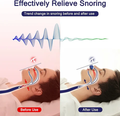 Micro CPAP Schlafapnoe-Maschine für Reisen &amp; Anti-Schnarchen - CPAP-Alternative