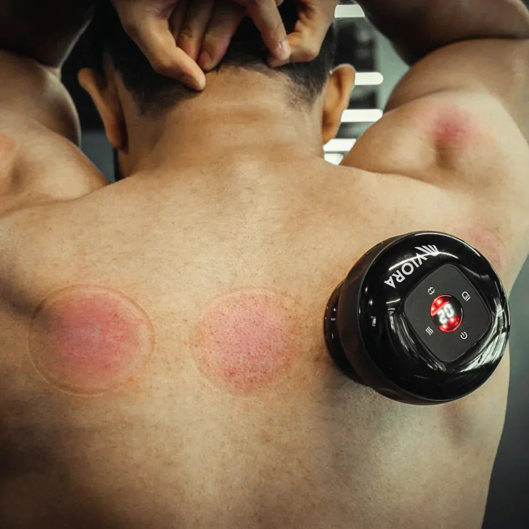 Innovatieve Cupping Therapie Massager für Muskel- und Hautpflege