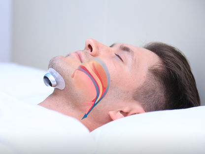 SnoozeFix Anti-Schnarch Gerät - Verbessere deinen Schlaf mit komfortabler Technologie