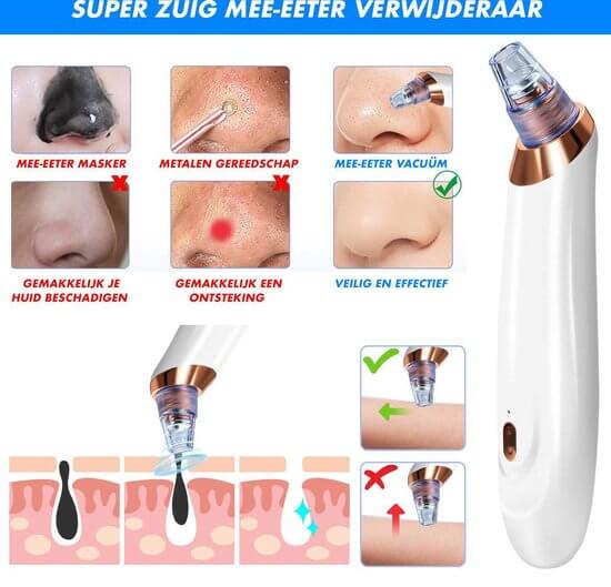 Elektrischer Porenreiniger für reine Haut