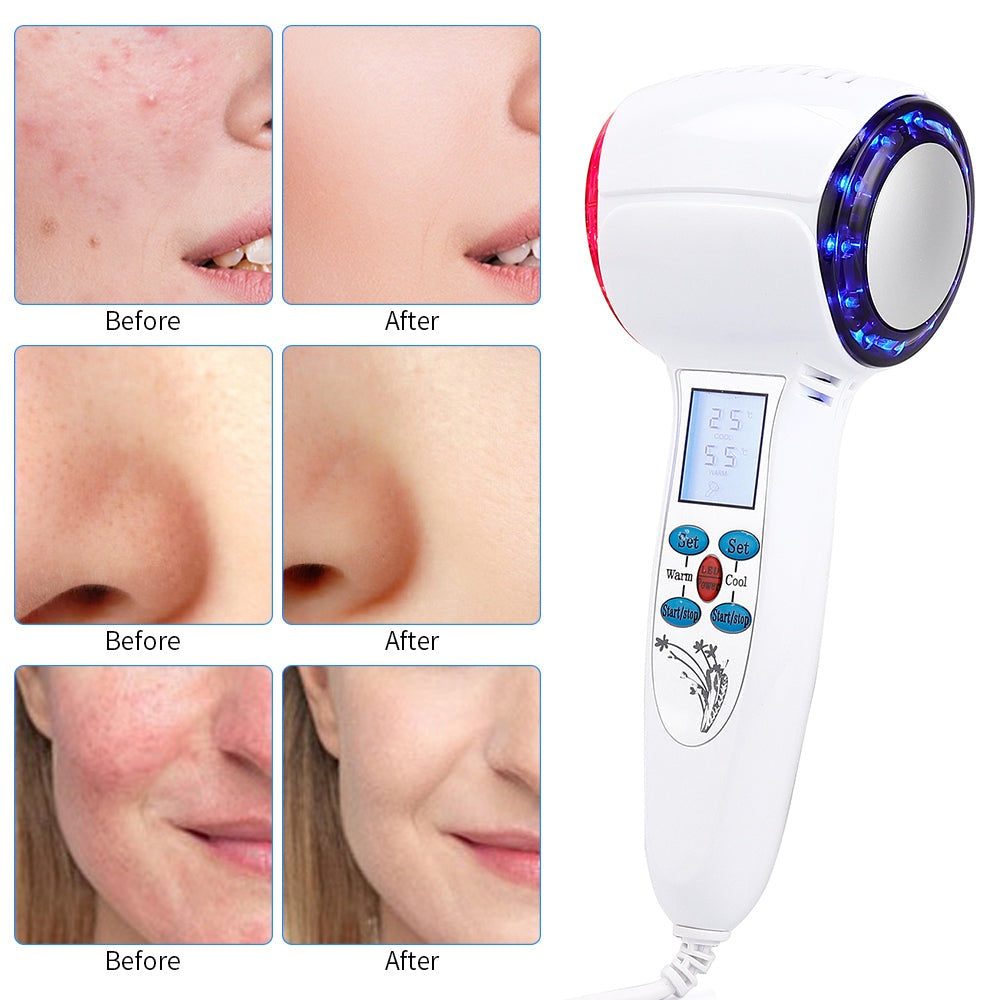 Zelara At-Home Facial Cryotherapie-Gerät