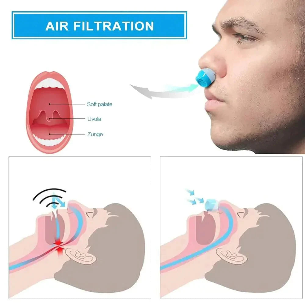 Micro CPAP Schlafapnoe-Maschine für Reisen &amp; Anti-Schnarchen – CPAP-Alternative