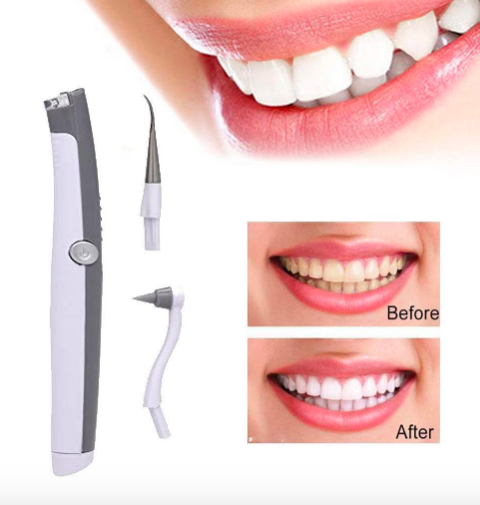 Sonic Zahnfleckenentferner mit Plaqueentfernung – 30.000 Vibrationen, LED Licht, 3 Aufsätze