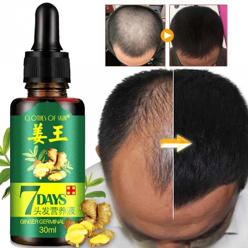 Haarwachstumsöl | 7 Tage Haarwachstums Ingwerserum