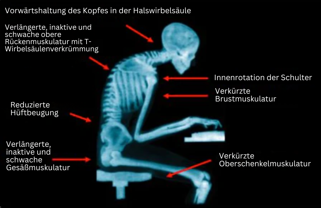EMS-Haltungsbandage - PosturePro