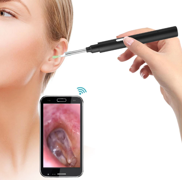 WiFi Ohrkamera 3MP HD, Kabellos, Wasserdicht, LED Beleuchtung, Ohrenschmalz Entfernung, Silikonaufsätze