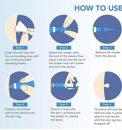 Hautwarzenentfernungskit – Schnelle, einfache und nicht irritierende Behandlung für glatte Haut