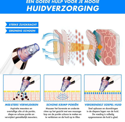 Elektrischer Mitesserentferner für reine Haut