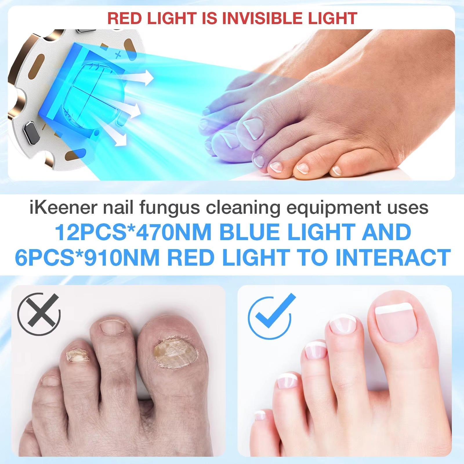 Nagelpilzlaser