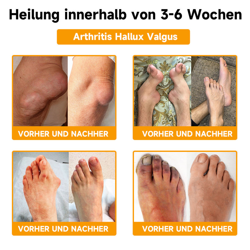 Bienengiftcreme | Salbe mit Bienengift, Hyaluron &amp; Kollagen | BeeLixir