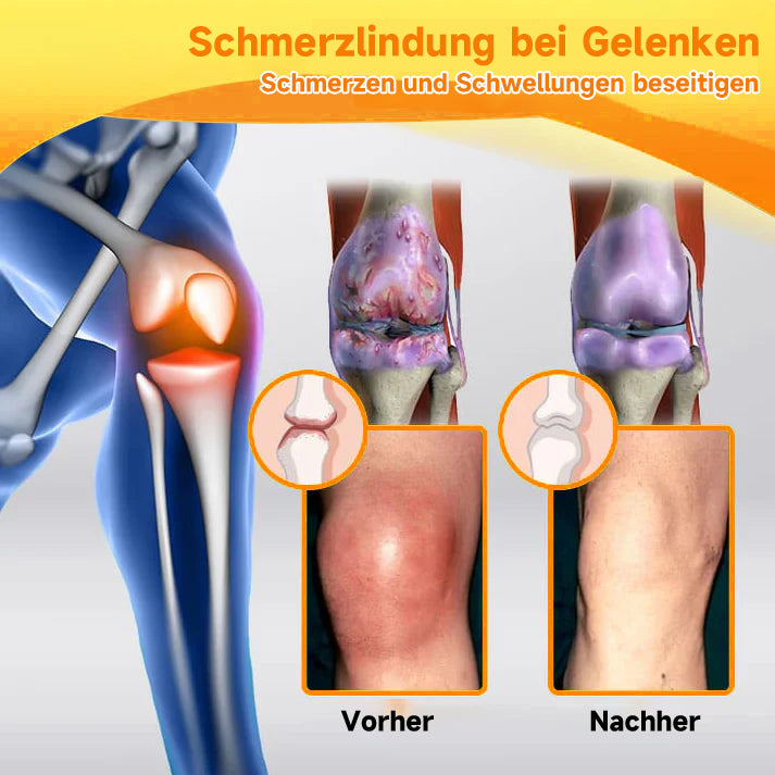 Bienengiftcreme | Salbe mit Bienengift, Hyaluron &amp; Kollagen | BeeLixir