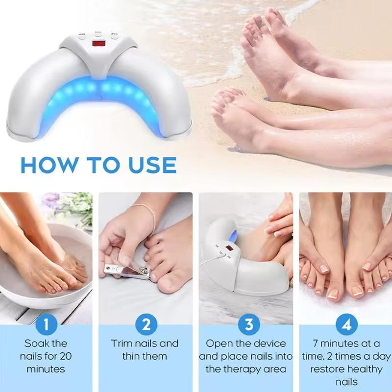 Nagelpilzlaser