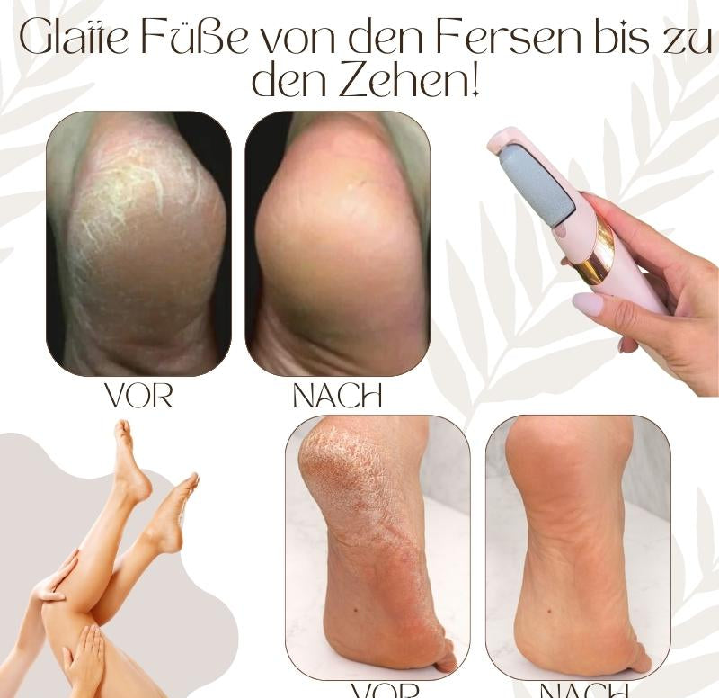 Elektrischer Hornhautentferner | LED-Licht | Wasserdicht