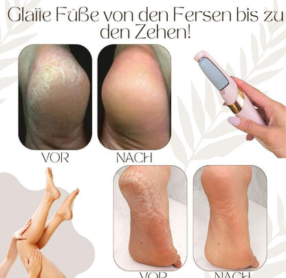 Elektrischer Hornhautentferner | LED-Licht | Wasserdicht