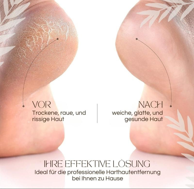 Elektrischer Hornhautentferner | LED-Licht | Wasserdicht