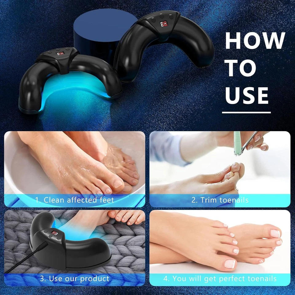 Nagelpilzlaser