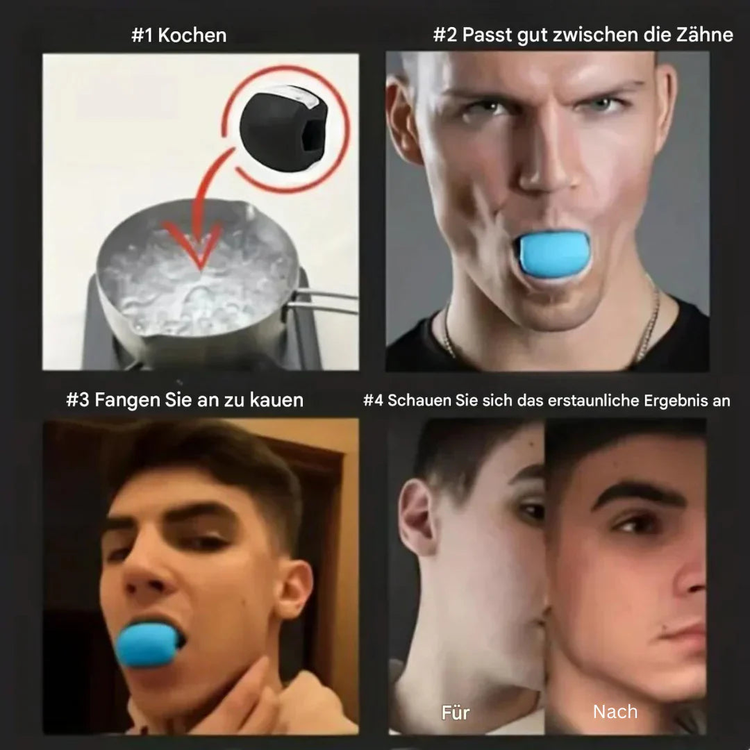Kiefertrainer für Definierte Kieferlinie
