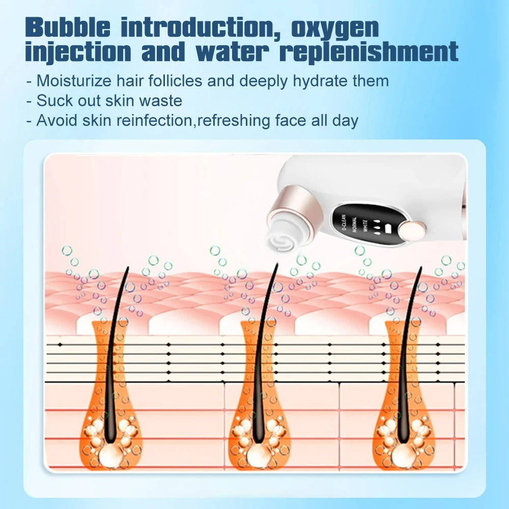 Mitesserentferner mit Präzisionssaugfunktion, wiederaufladbar, einstellbare Intensität, tragbares Porenreinigungsgerät