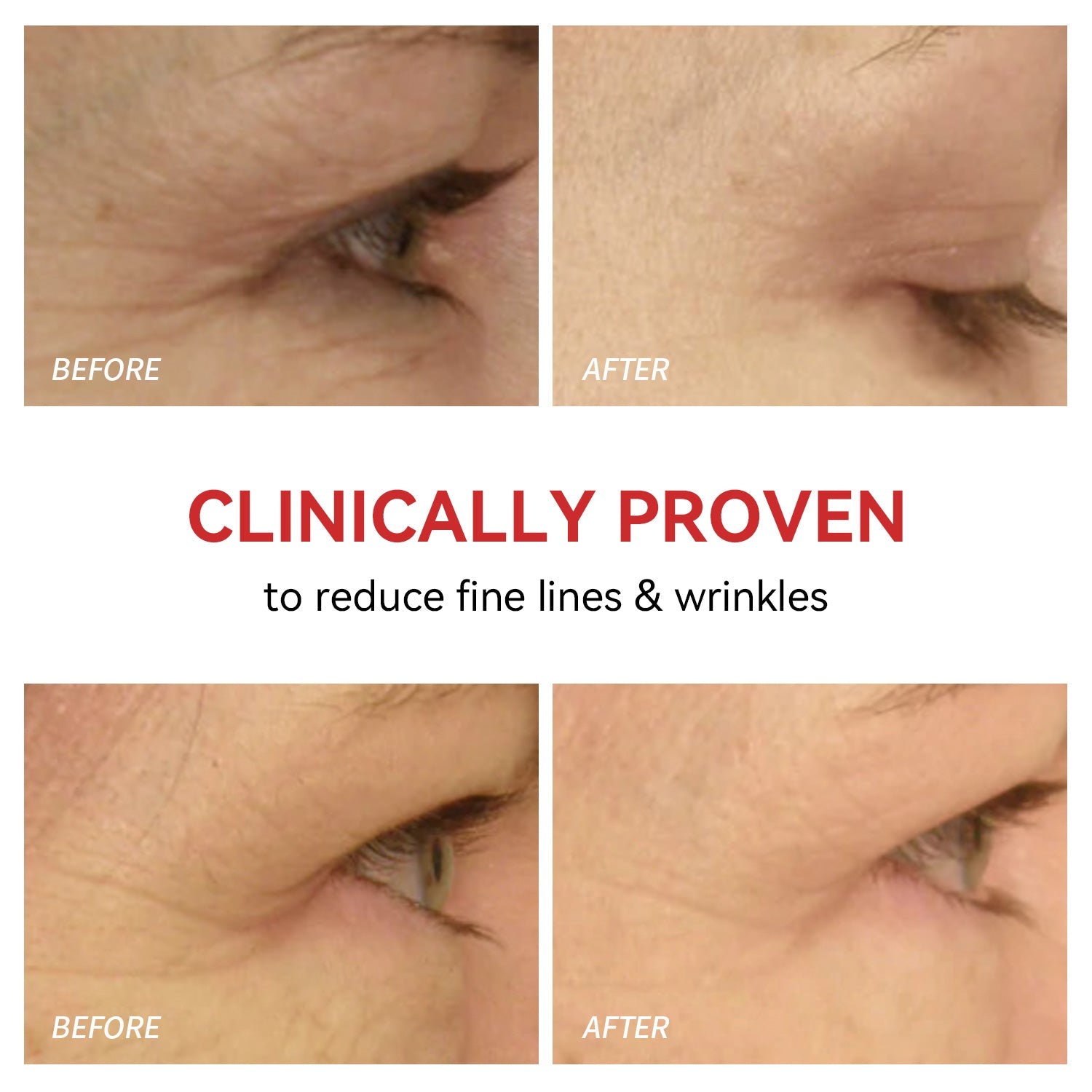 Rotlicht-Therapiegerät für Augen – Schmerzlinderung &amp; Sehkraftverbesserung zu Hause