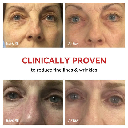 Rotlicht-Therapiegerät für Augen – Schmerzlinderung &amp; Sehkraftverbesserung zu Hause