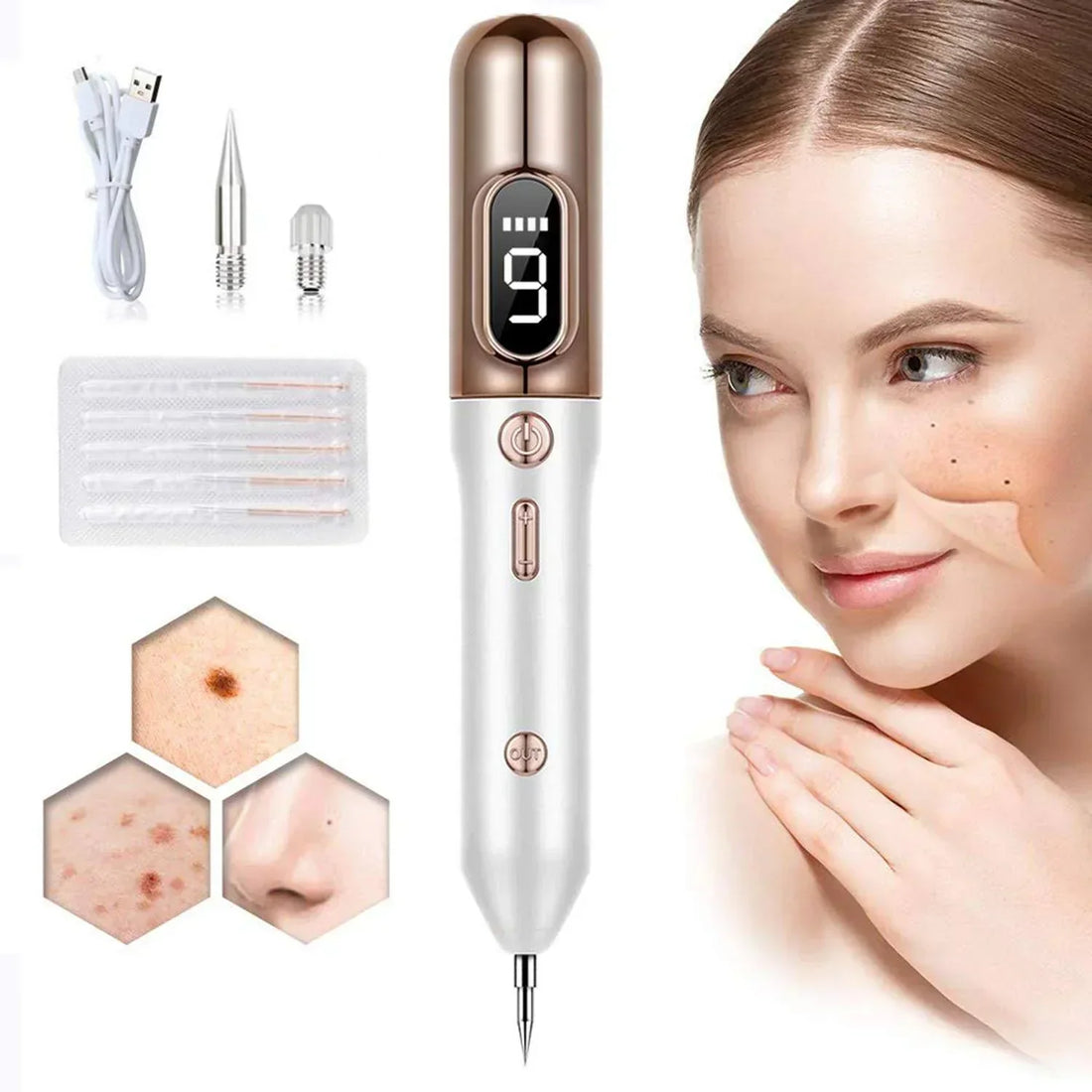 Plasma Pen zur Entfernung von Hautmale, Muttermalen und Warzen